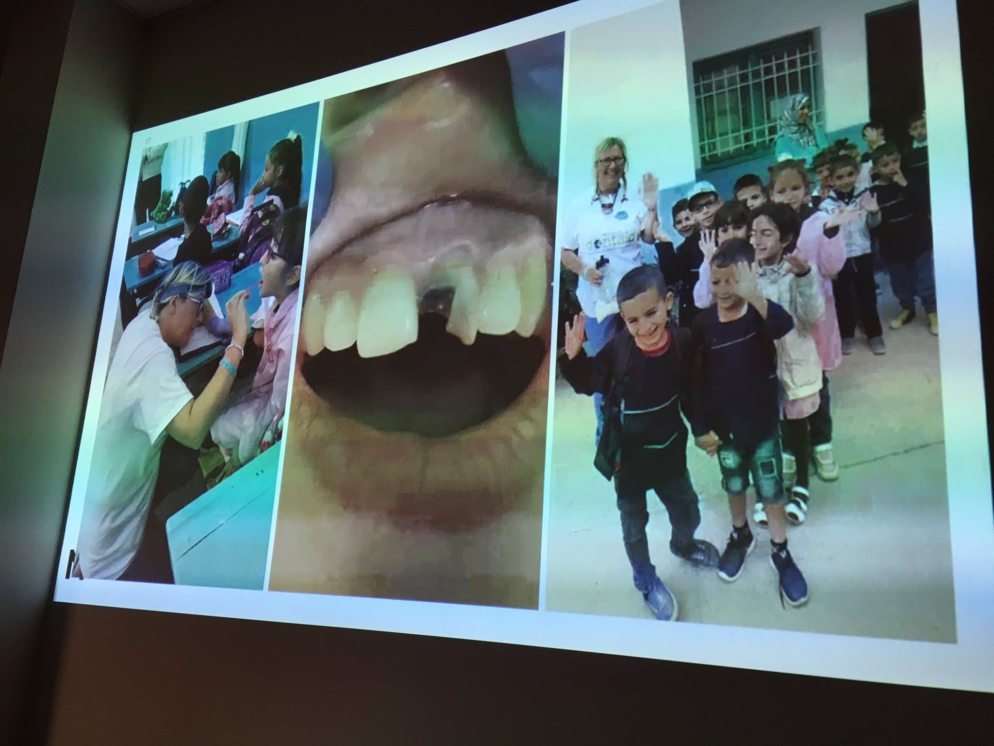 Photos of Dentaid volunteering trip to Morocco by West Country Dental Care dental nurse